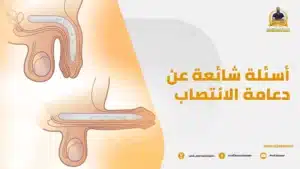 Read more about the article أسئلة شائعة عن دعامة الانتصاب