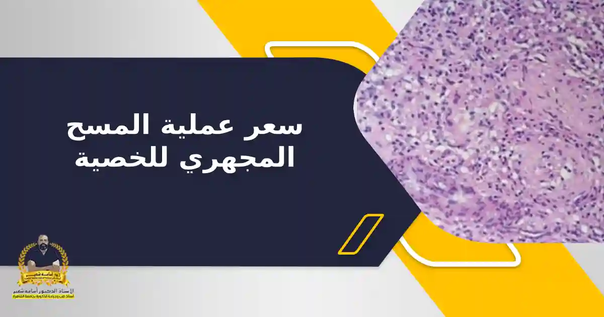 سعر عملية المسح المجهري للخصية