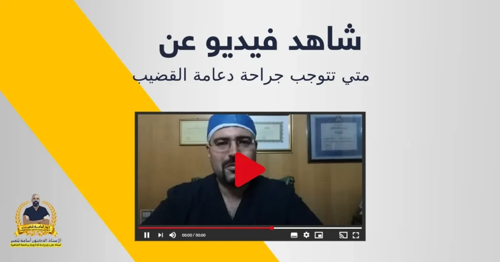 متي تتوجب جراحة دعامة القضيب