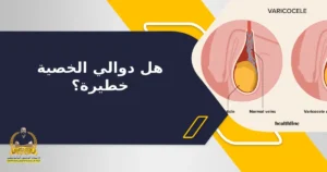 Read more about the article هل دوالي الخصية خطيرة؟
