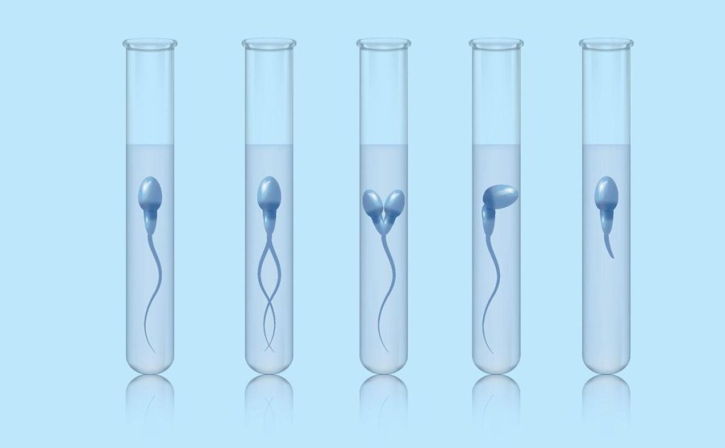 Semen Analysis