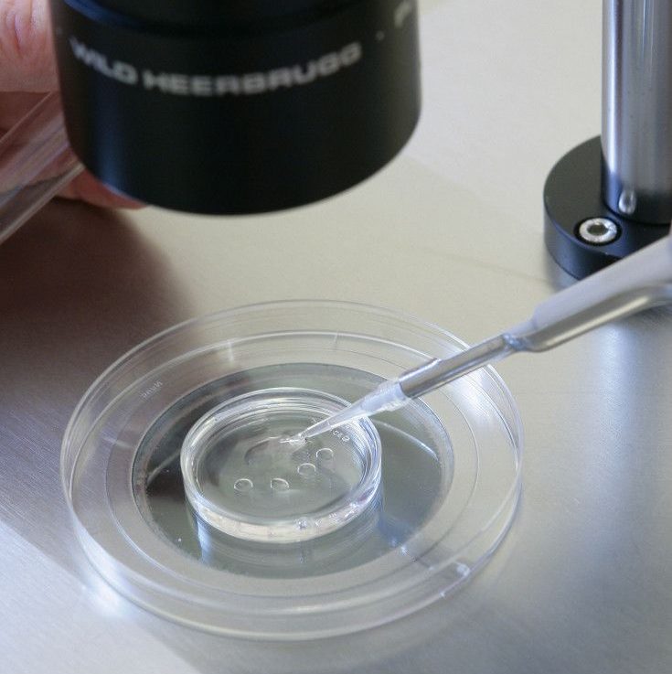 Semen Analysis
