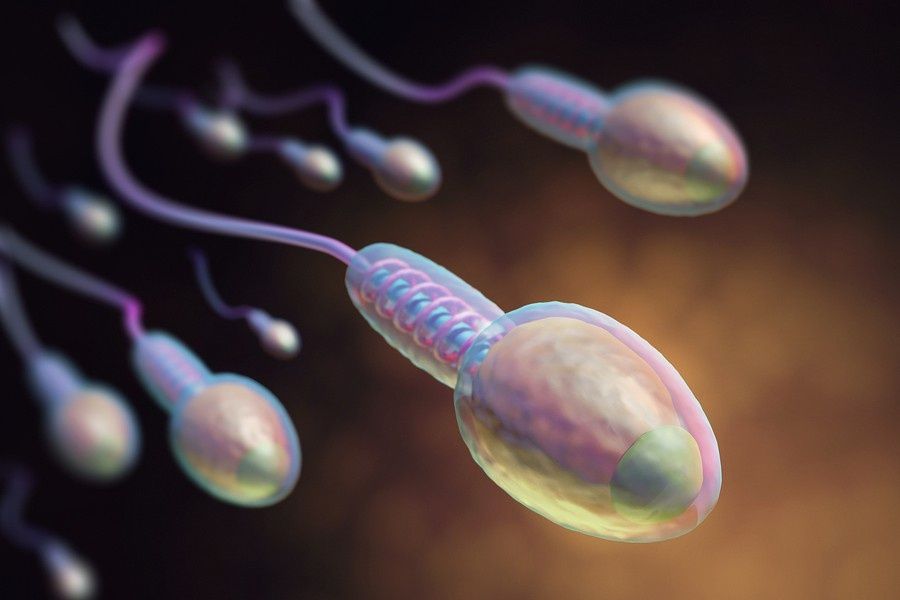 Genetic Testing in Azoospermia