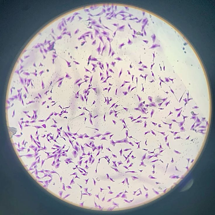 Male Infertility Evaluation